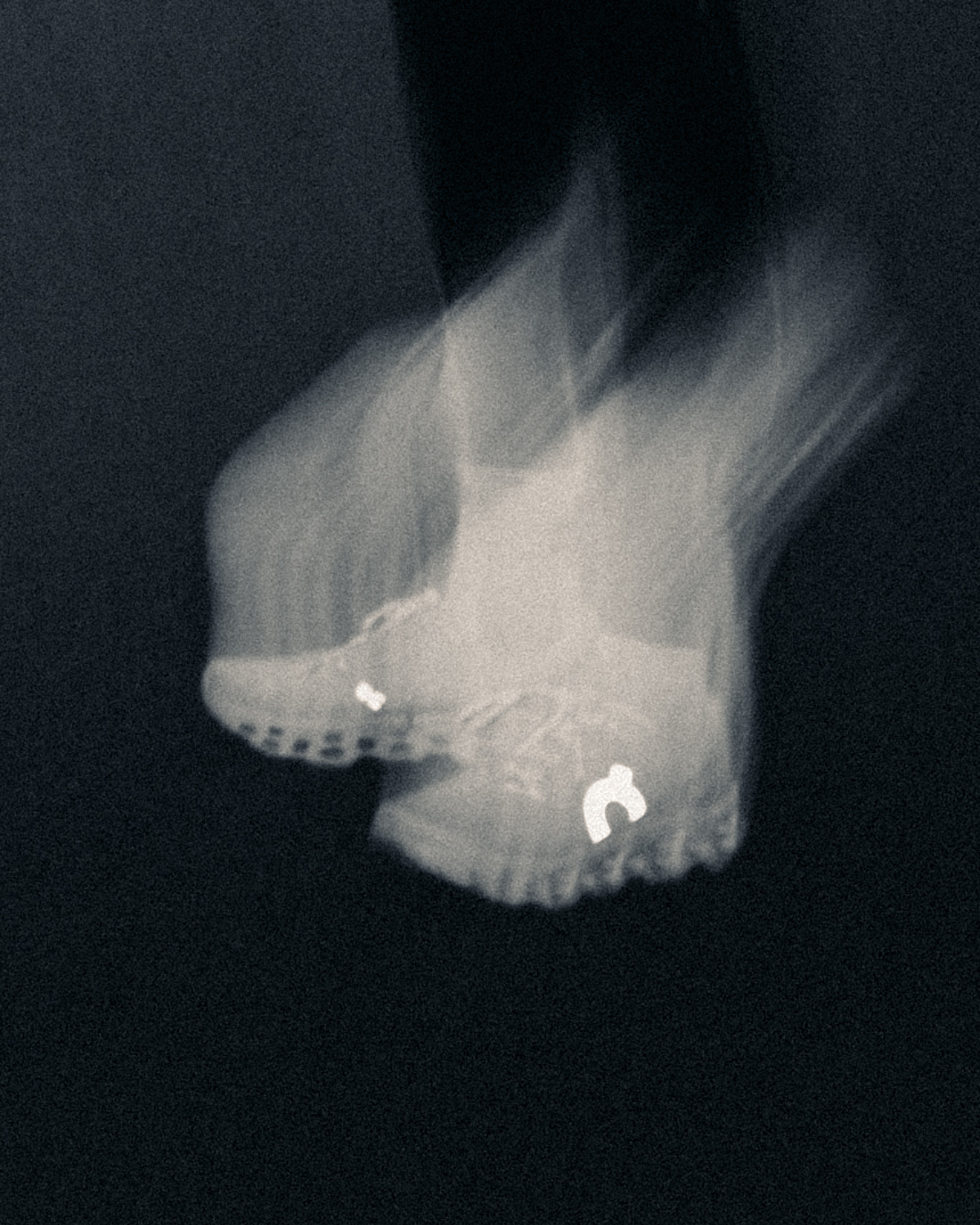 Cloudmonster 3 testsko