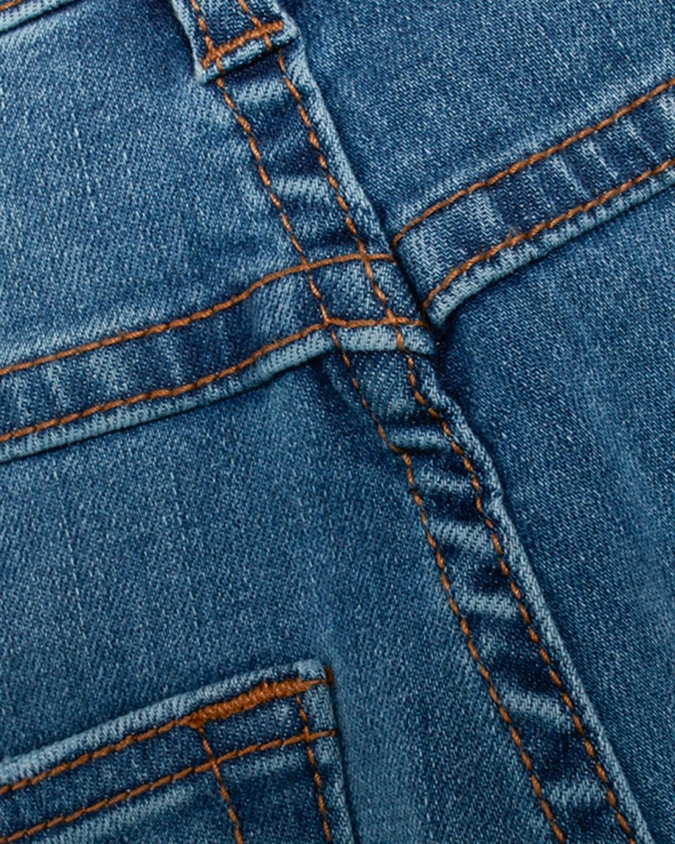 Stay Vintage - Acid Blue - Munk Store